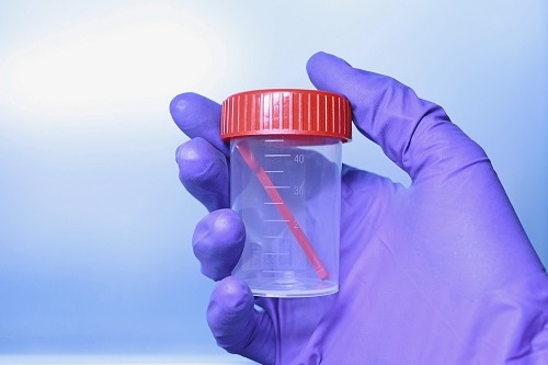 Диагностика язвенного колита